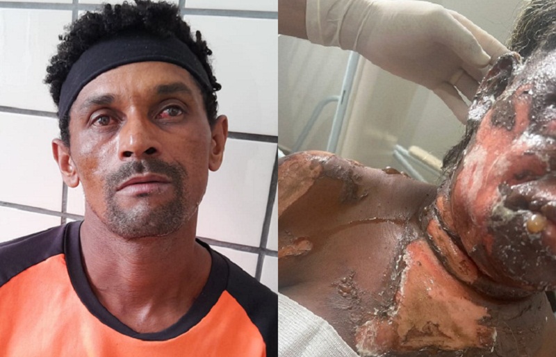 Crime chocante: Homem é preso em flagrante pela PM logo após atear fogo na própria esposa, em Ibirapuã; vítima está em estado grave